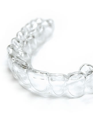 clear aligners